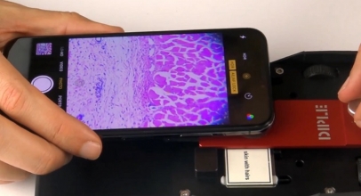 SmartMicroOptic dengan Smartphone Lihat Bakteri